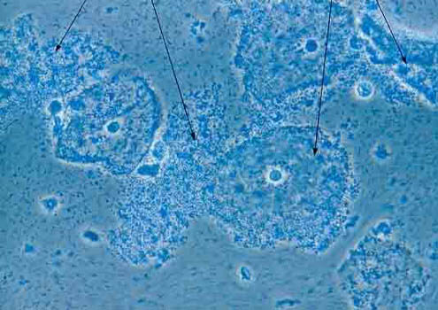 Bakteri Penyebab Keputihan di Bawah Mikroskop