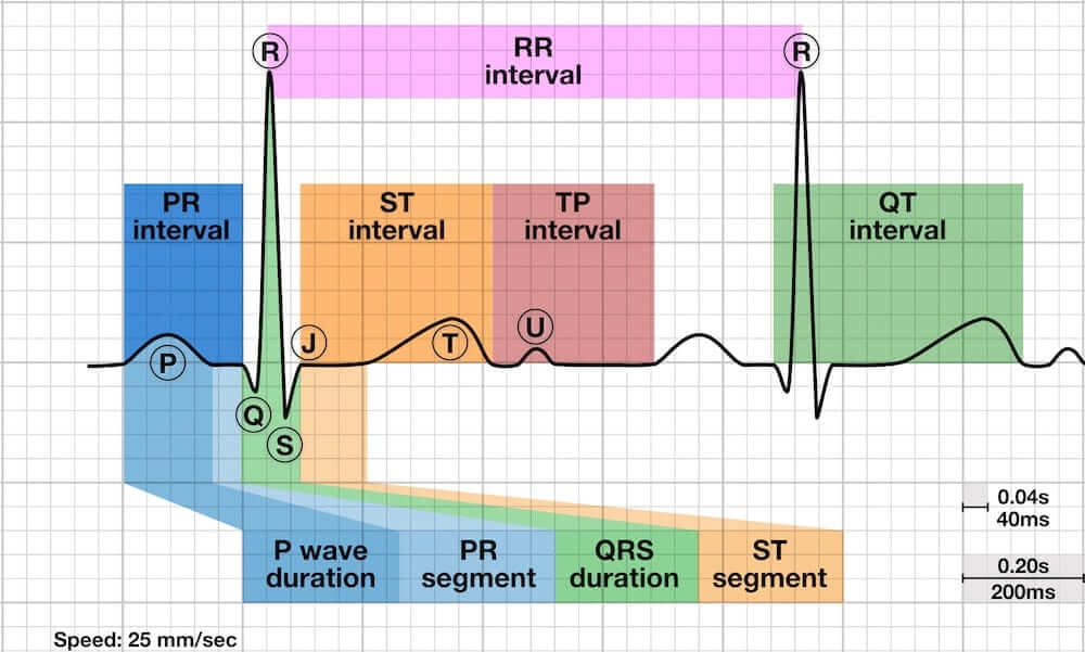 Komponen Rekaman EKG normal