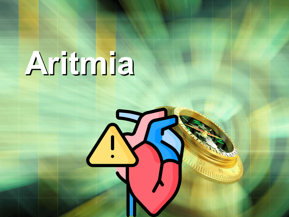 Download Slide Presentasi Aritmia